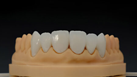 DENTAL CROWN