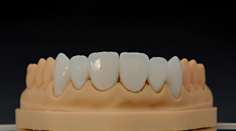 DENTAL CROWN