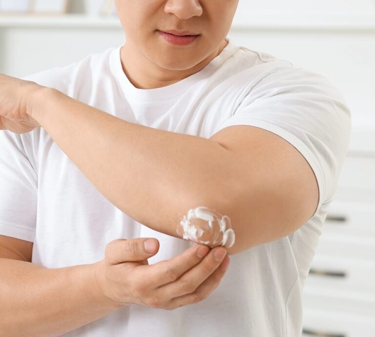 Eczema, Psoriasis, Dry Itchy Skin What Actually Helps